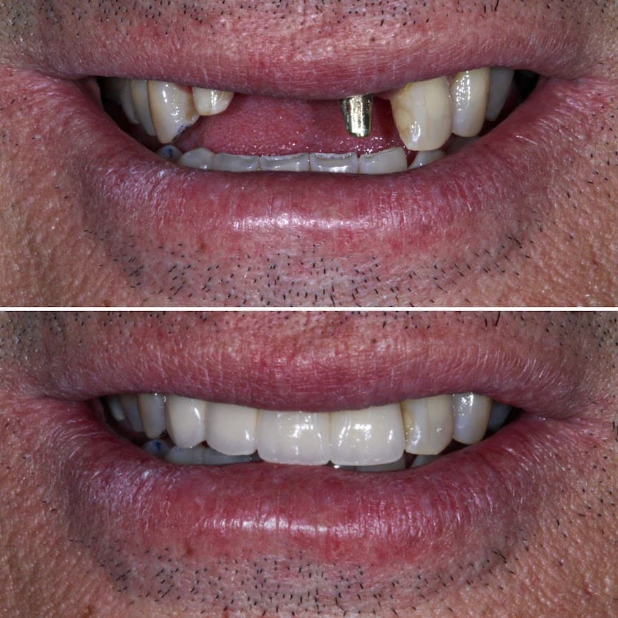 Antes e depois de um tratamento odontológico