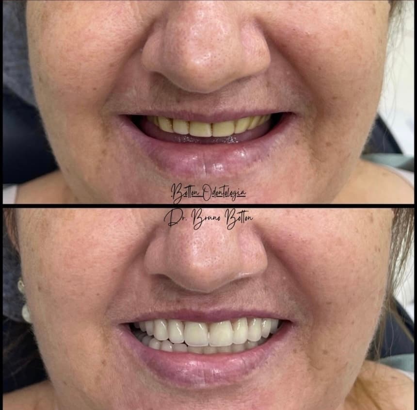 Antes e depois de um tratamento odontológico